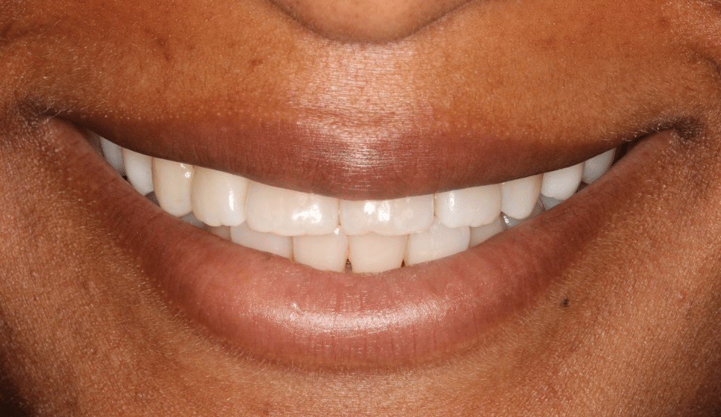 Before - Fleckney Dental & Cosmetic Clinic