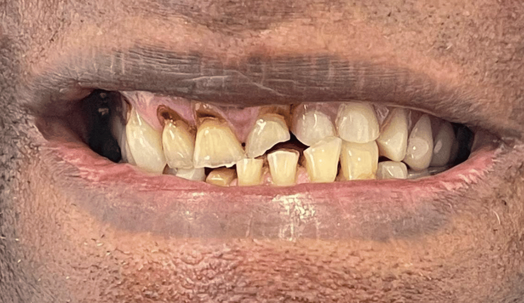 Before - Fleckney Dental & Cosmetic Clinic