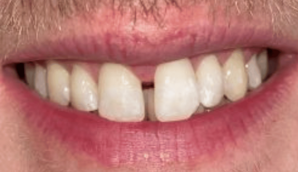 Before - Fleckney Dental & Cosmetic Clinic