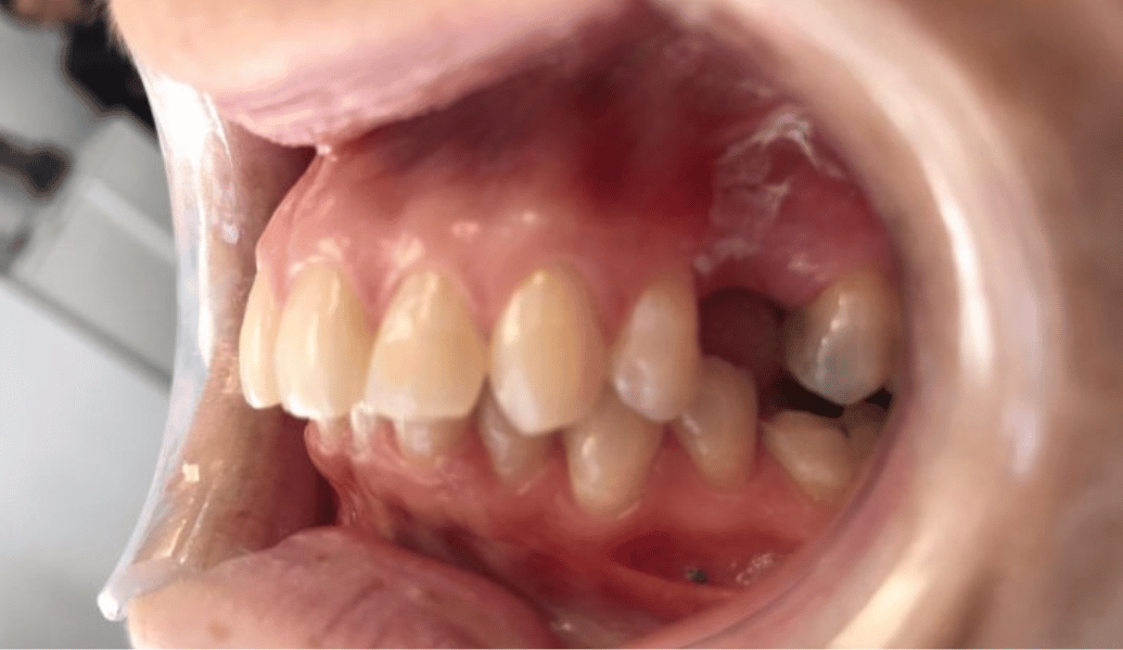 Before - Fleckney Dental & Cosmetic Clinic