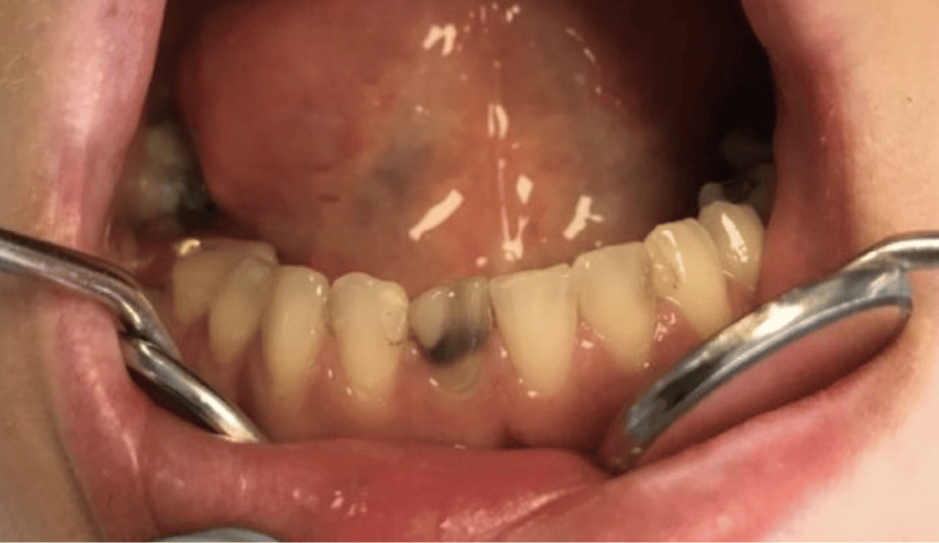 Before - Fleckney Dental & Cosmetic Clinic