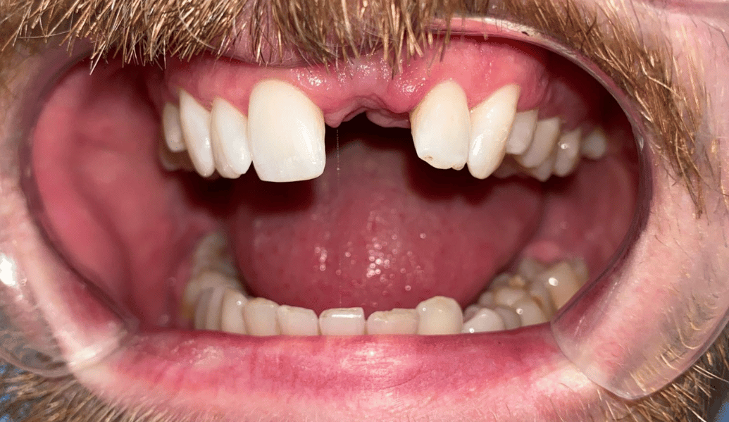 Before - Fleckney Dental & Cosmetic Clinic