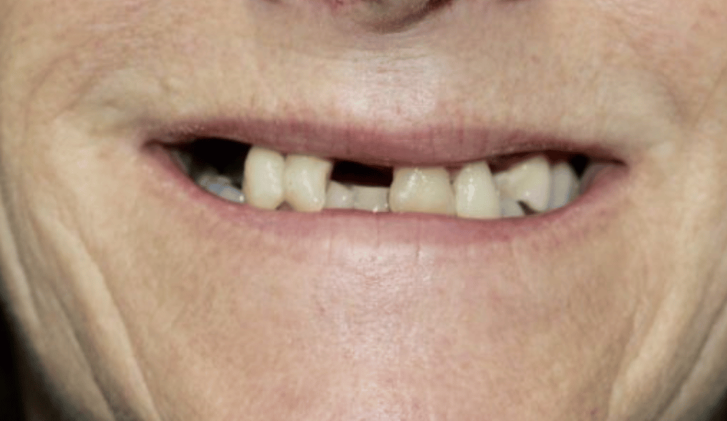 Before - Fleckney Dental & Cosmetic Clinic