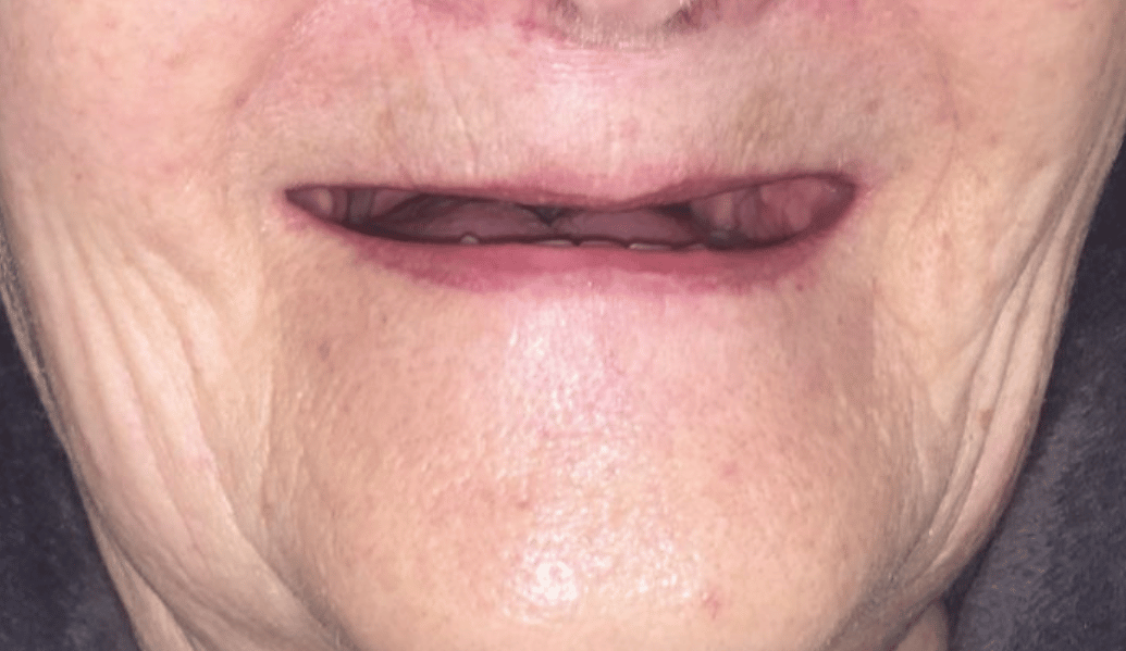 Before - Fleckney Dental & Cosmetic Clinic