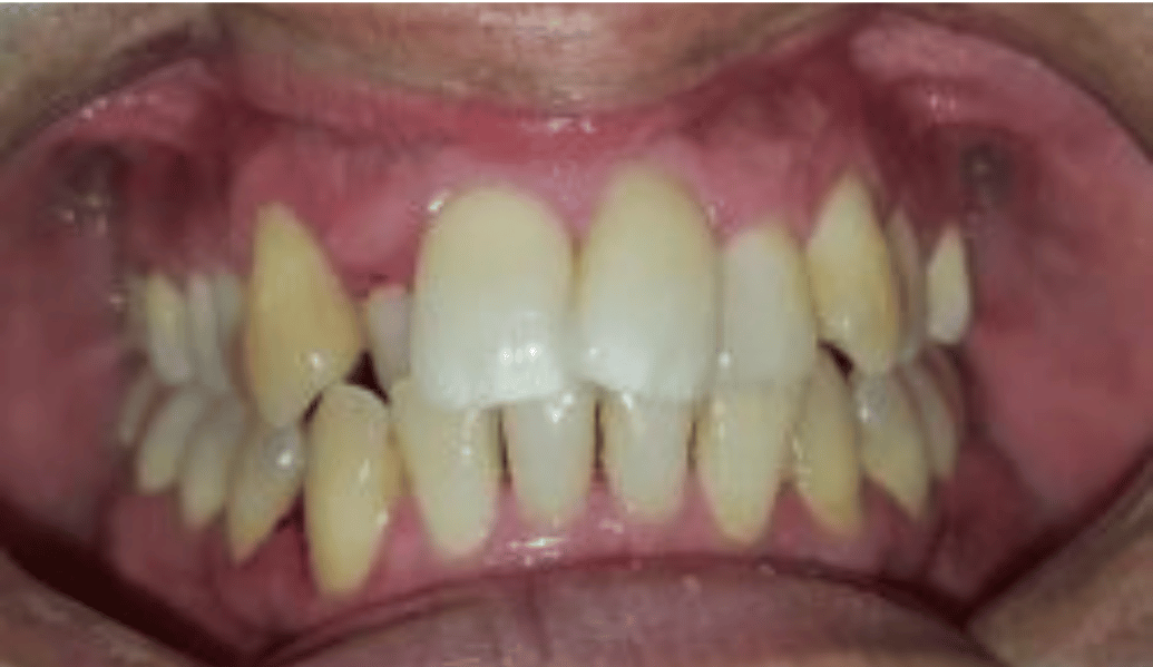 Before - Fleckney Dental & Cosmetic Clinic