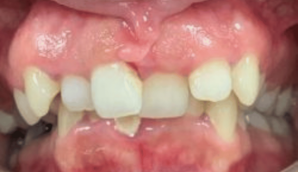 Before - Fleckney Dental & Cosmetic Clinic