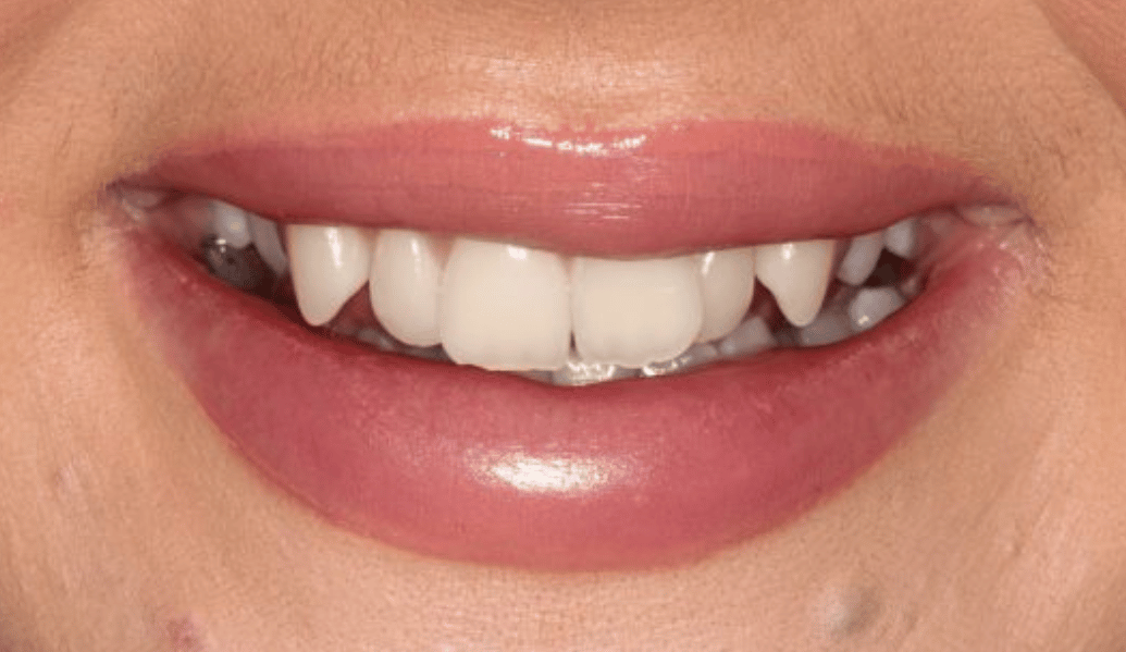 Before - Fleckney Dental & Cosmetic Clinic