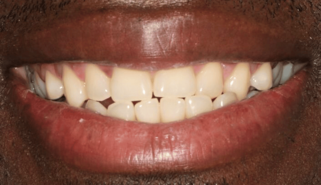 Before - Fleckney Dental & Cosmetic Clinic