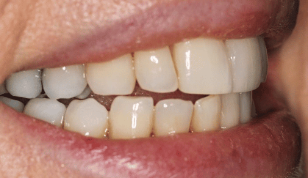 Before - Fleckney Dental & Cosmetic Clinic